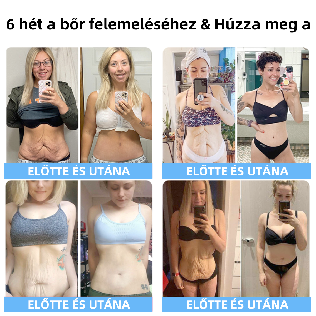 🔥🔥Utolsó nap akció: 75%-os kedvezmény🫧Fubsta® Haladó rögzítő és ránc-eltüntető krém: A bőr rugalmasságának helyreállítása-2024