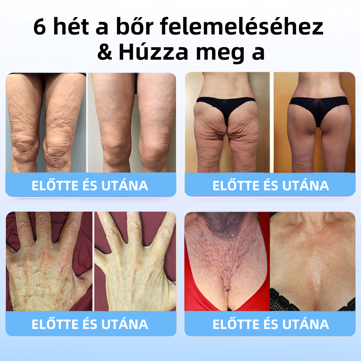 🔥🔥Utolsó nap akció: 75%-os kedvezmény🫧Fubsta® Haladó rögzítő és ránc-eltüntető krém: A bőr rugalmasságának helyreállítása-2024