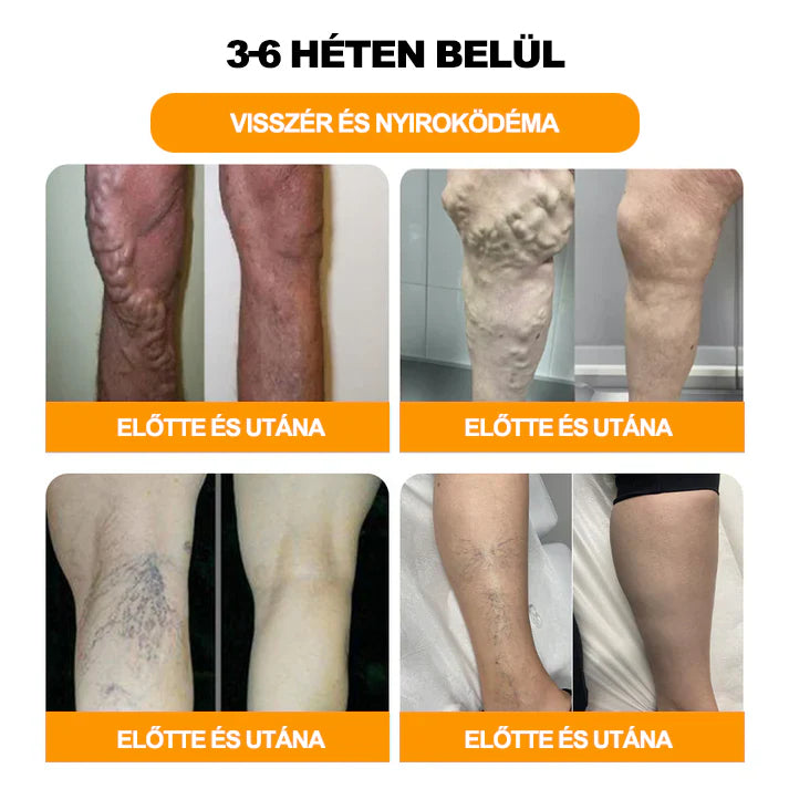 đPurefeetâą 30-gyĂłgynövĂ©nyes fogyĂłkĂșrĂĄs Ă©s mĂ©regtelenĂtĆ lĂĄbfĂŒrdĆ gyöngy - Orvos ĂĄltal javasolt - Minden nyirokproblĂ©mĂĄra Ă©s elhĂzĂĄsra alkalmas -đCE tanĂșsĂtvĂĄnnyalđ