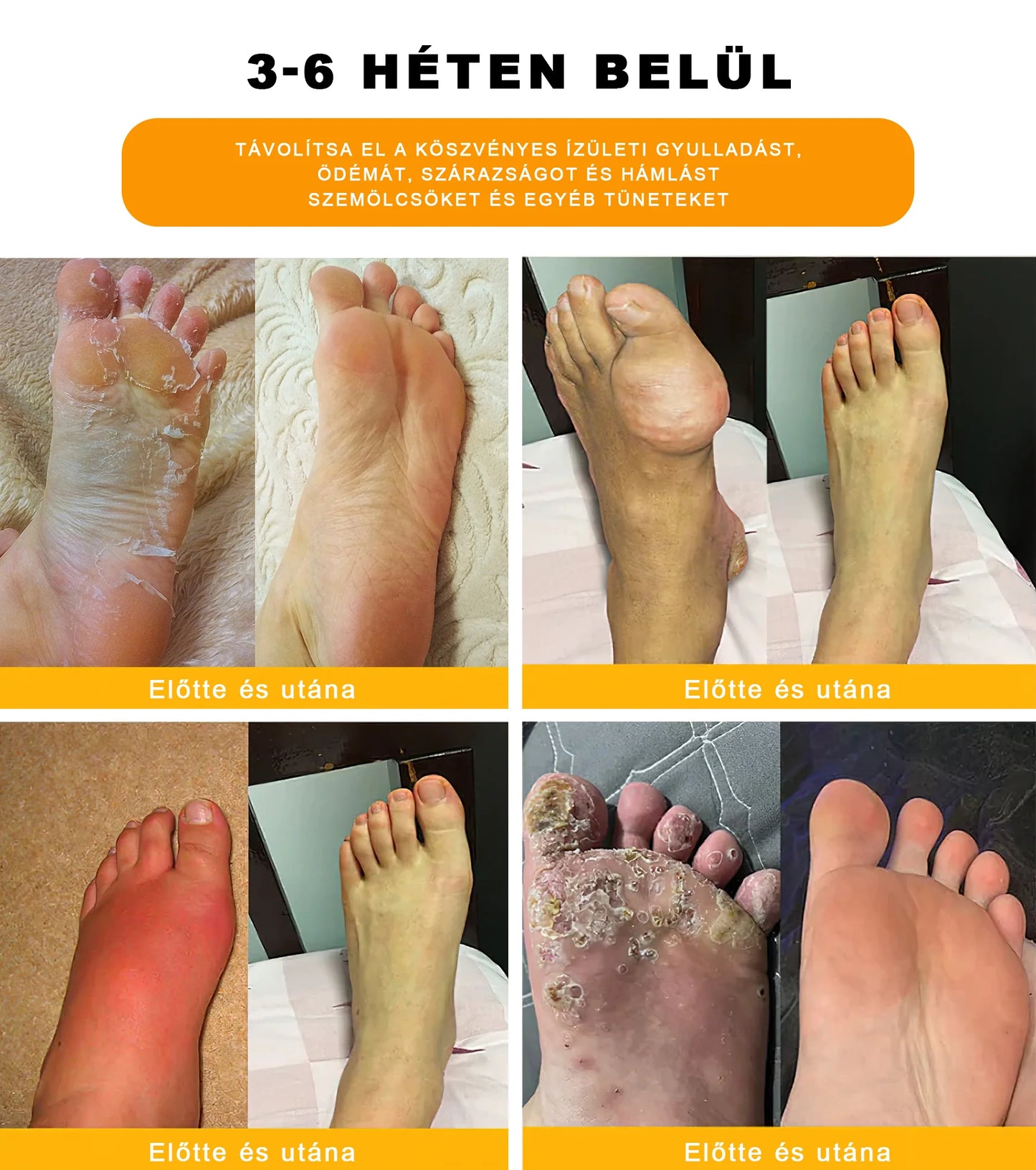 đPurefeetâą 30-gyĂłgynövĂ©nyes fogyĂłkĂșrĂĄs Ă©s mĂ©regtelenĂtĆ lĂĄbfĂŒrdĆ gyöngy - Orvos ĂĄltal javasolt - Minden nyirokproblĂ©mĂĄra Ă©s elhĂzĂĄsra alkalmas -đCE tanĂșsĂtvĂĄnnyalđ