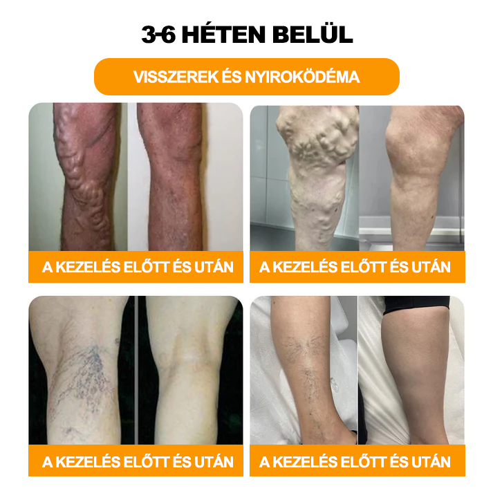 đđđđĄđđđ§đ âą đđ đĂ©đ„đ đ đČĂłđ đČđ§Ă¶đŻĂ©đ§đČđđŹ đ„ĂĄđđĂŒđ«đĆ đ đšđ„đČĂł đ đđšđ đČĂĄđŹ Ă©đŹ đ đŠĂ©đ«đđ đđđ„đđ§ĂđĂ©đŹ Ă©đ«đđđ€Ă©đđđ§ - â€ïžâš (đđđ đđđ§ĂșđŹĂđđŻĂĄđ§đČ, đđđ đČđđ« đđąđŠđđšđ„Ăłđ đąđđą đĂĄđ«đŹđđŹĂĄđ )âš