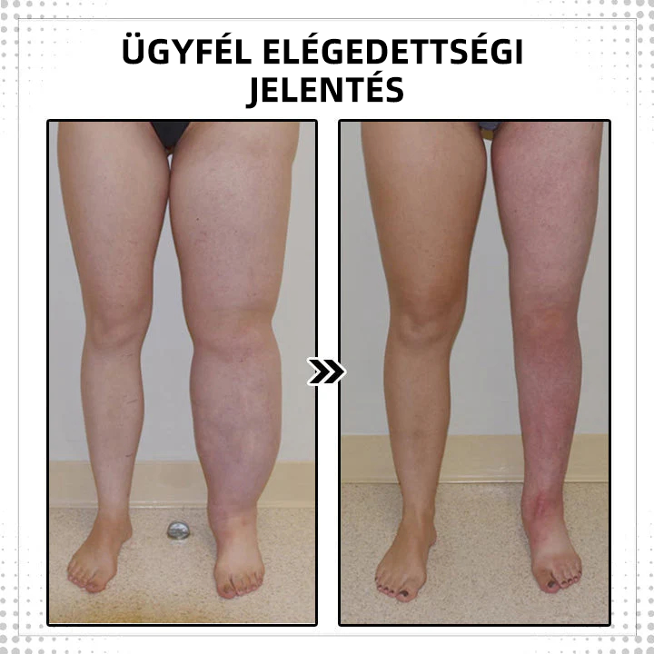 đŻđđđđđđâąHĆterĂĄpiĂĄs MĂ©regtelenĂtĆ TestgyƱrƱ (KorlĂĄtozott ideig tartĂł kedvezmĂ©ny đ„ utolsĂł nap) đ